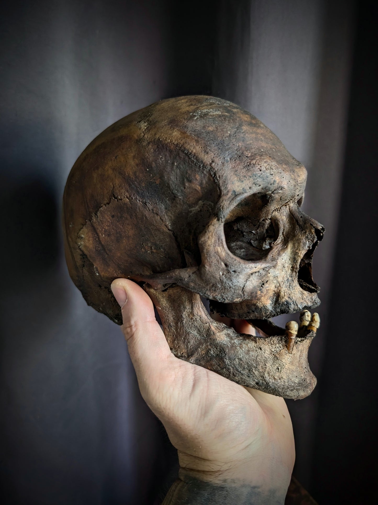 Antique skull with a beautiful dark patina and a broad mandible (from Italy late 19th century)