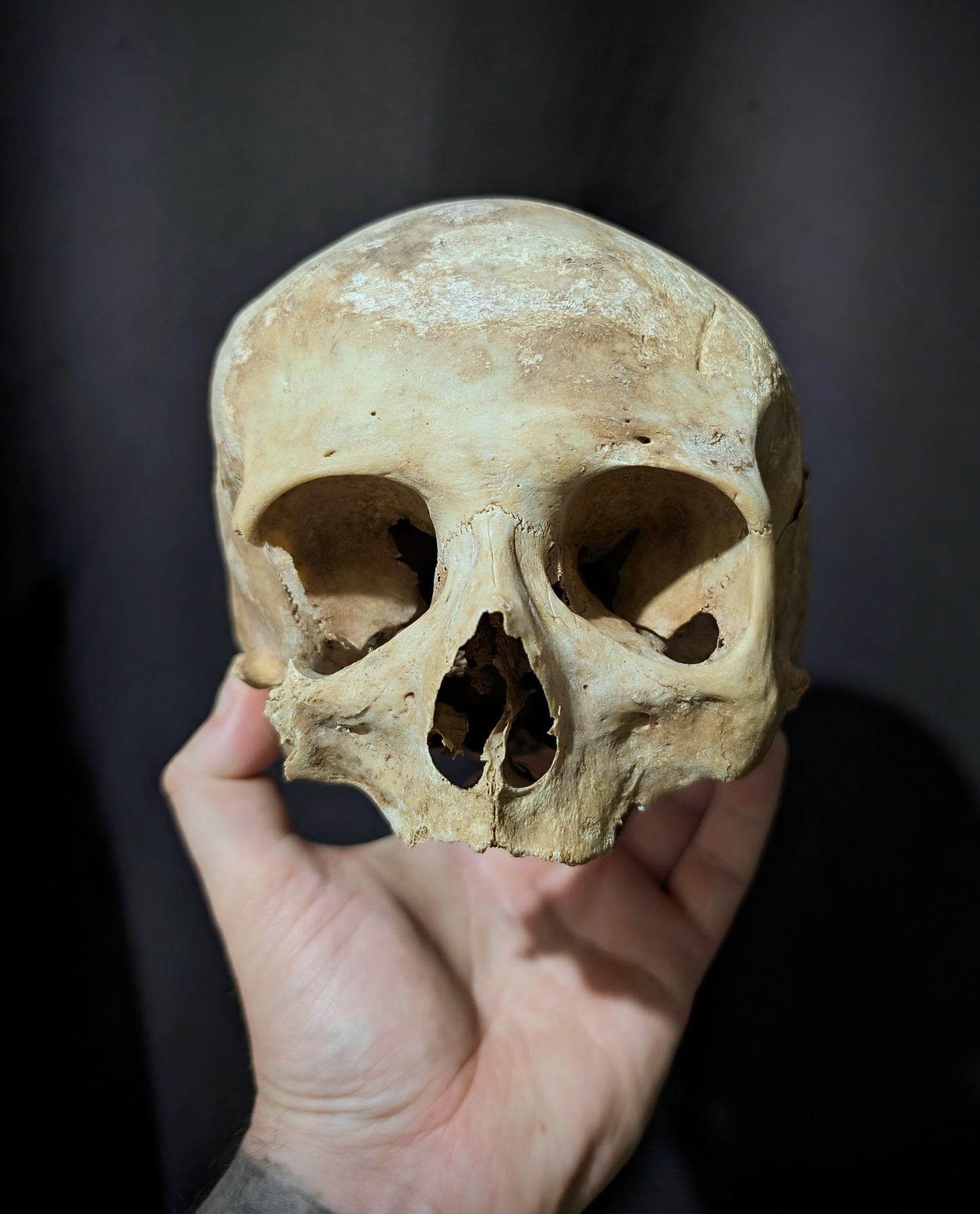 Old skull from late 19th century (Germany)