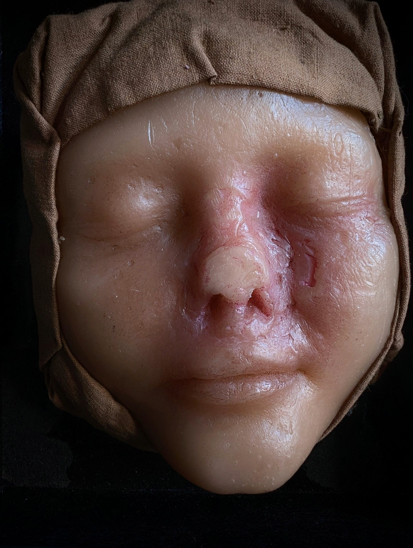 Vintage Medical Wax Moulage – Post-Mortem Study of a Woman Following Nasal Necrosis (Post Mortem)