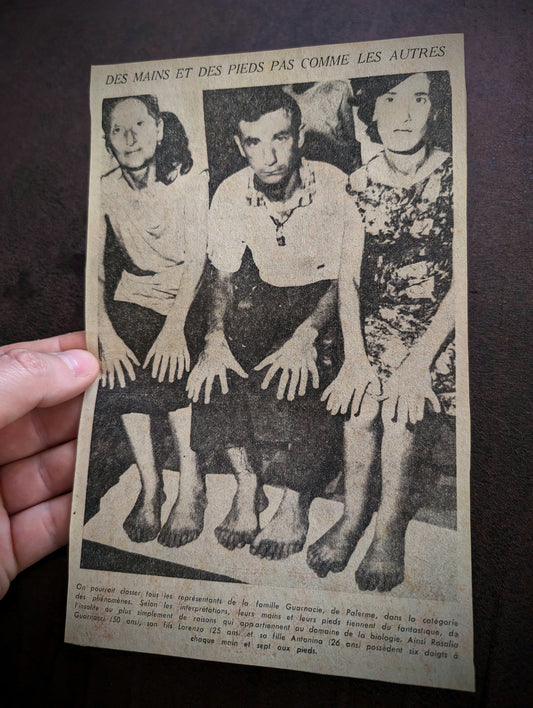 6 fingers ? Yes, it's possible ! Old newspaper article (Freak)