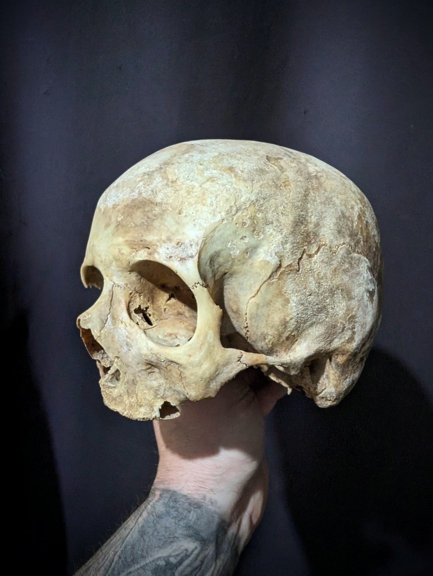 Old skull from late 19th century (Germany)