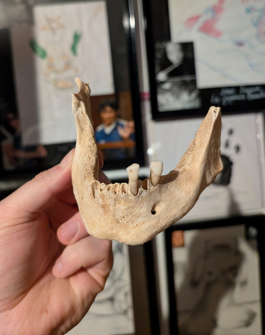 Old mandible from 19th century (Germany)