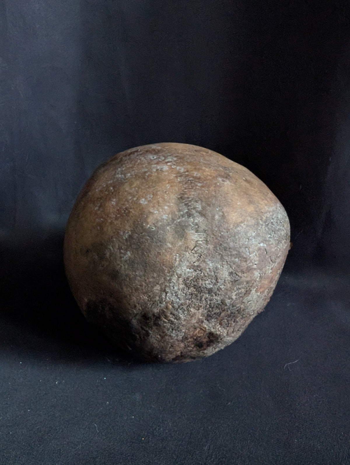 Antique Woman Skull with dark patina – Unusual Cranial Shape (Mid-19th Century, Italy)