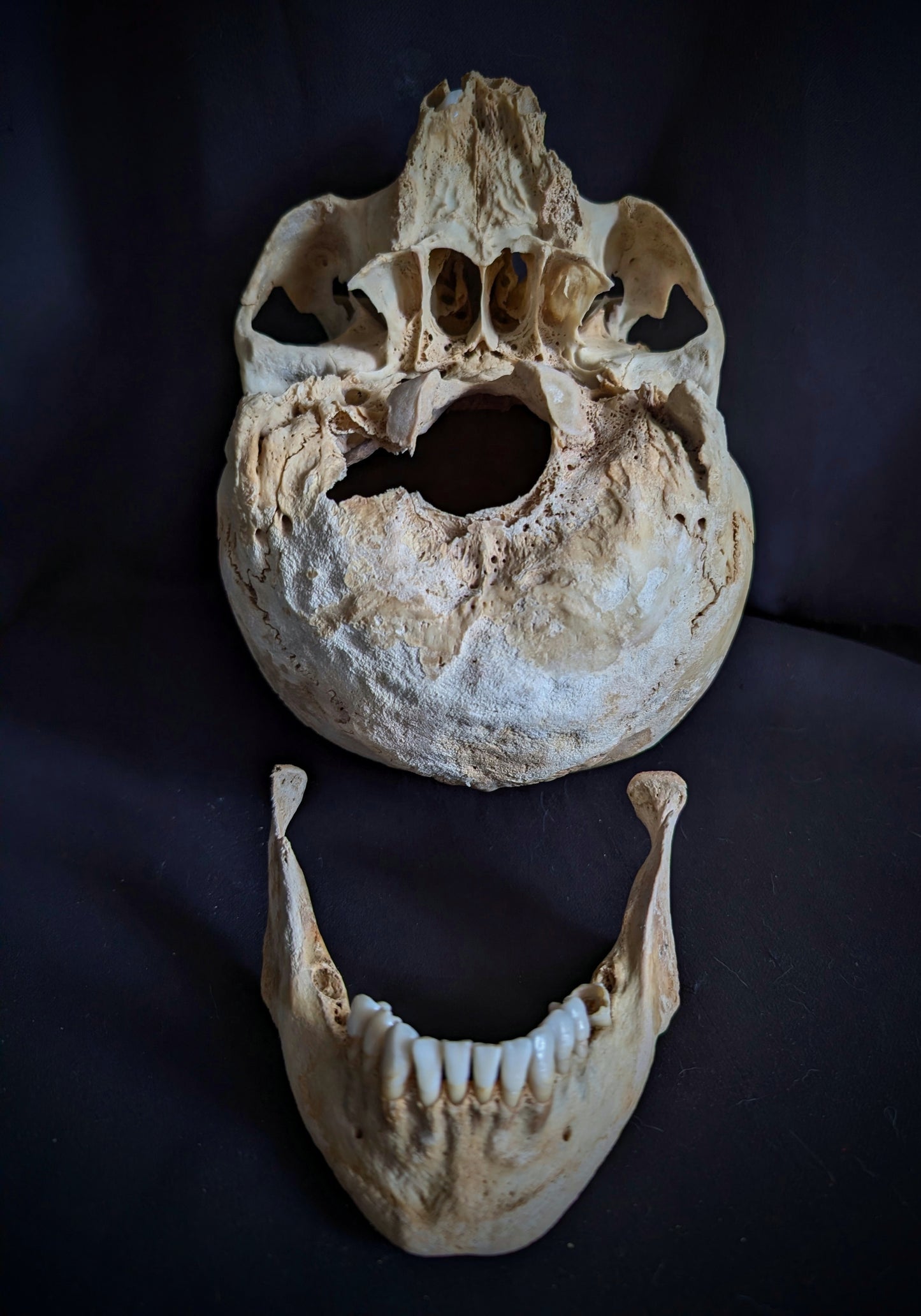 An antique German skull from the late 19th century