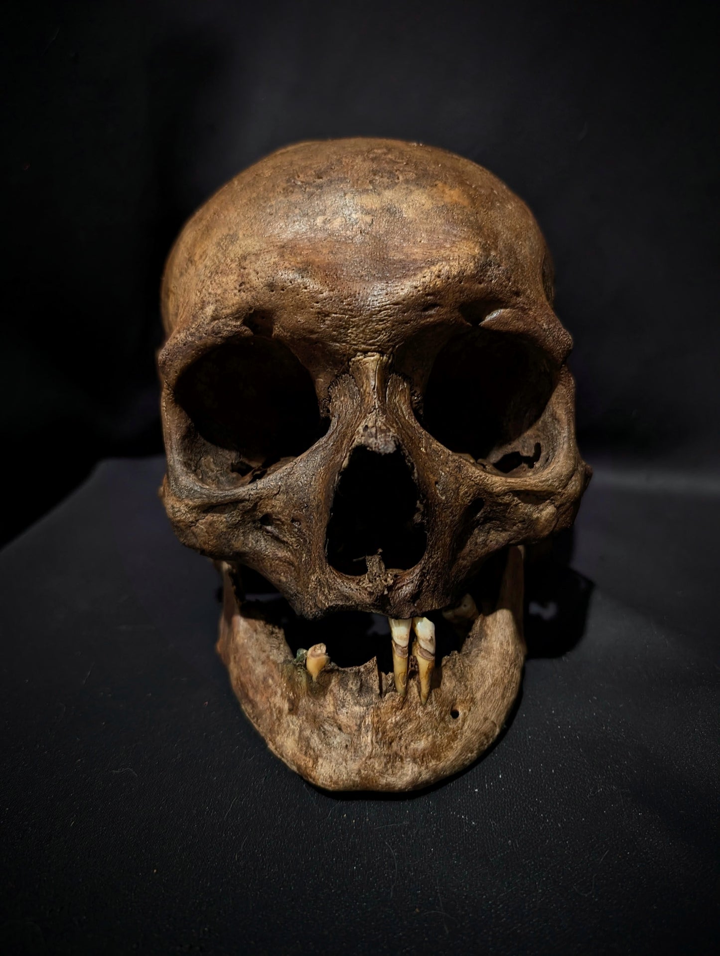A beautiful antique skull from the 19th century with a dark patina (from a private collection in Italy)