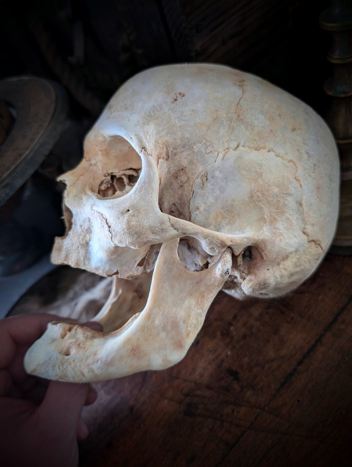 Ancient geriatric male skull (late 19th century, Italy)