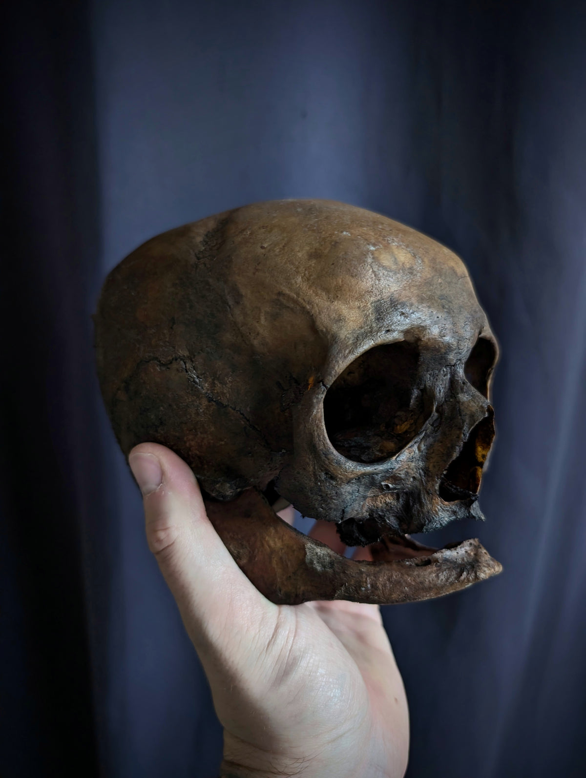 Antique Woman Skull with dark patina – Unusual Cranial Shape (Mid-19th Century, Italy)