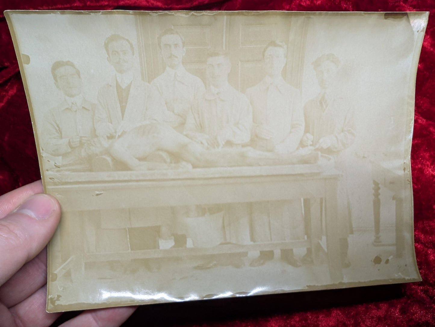 Old Autopsy photo early 1910's #2
