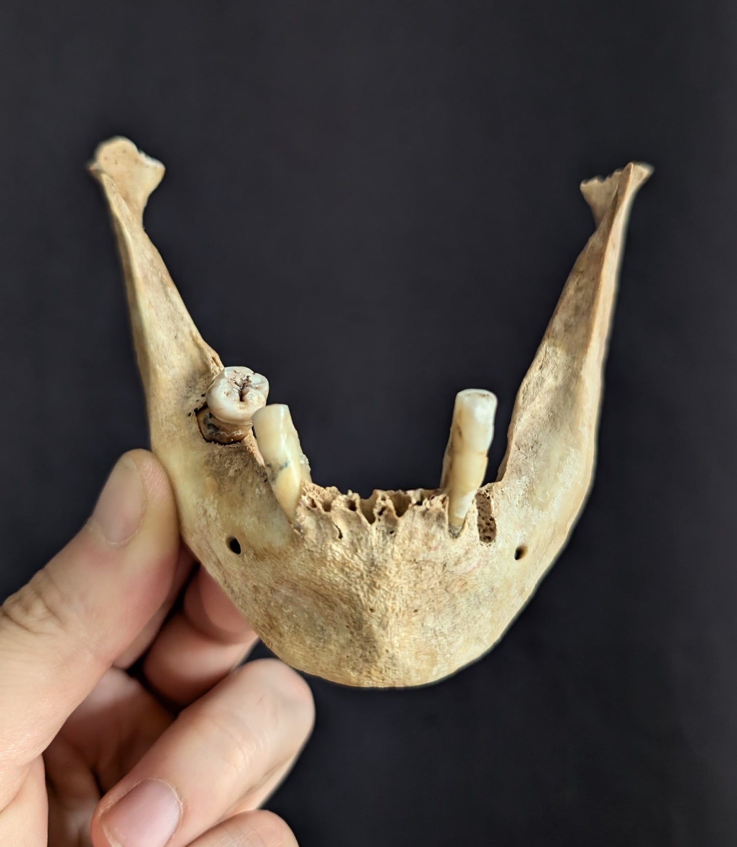Old mandible